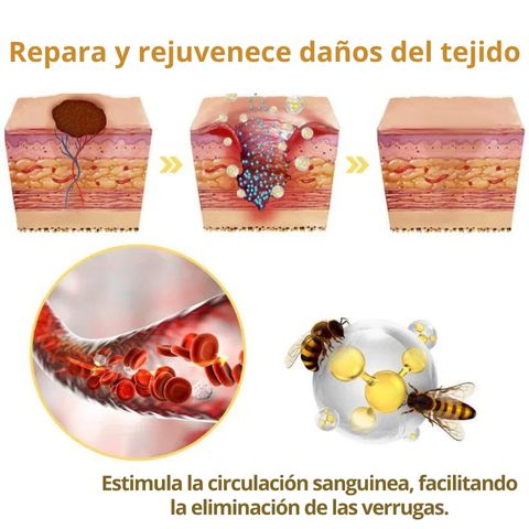 AG RECEDE- REMOVEDOR DE IMPERFECCIONES