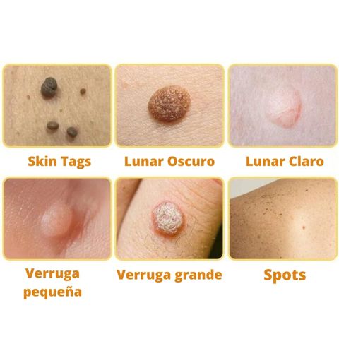 AG RECEDE- REMOVEDOR DE IMPERFECCIONES