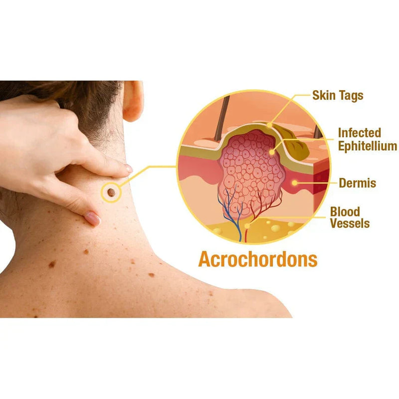 AG RECEDE- REMOVEDOR DE IMPERFECCIONES